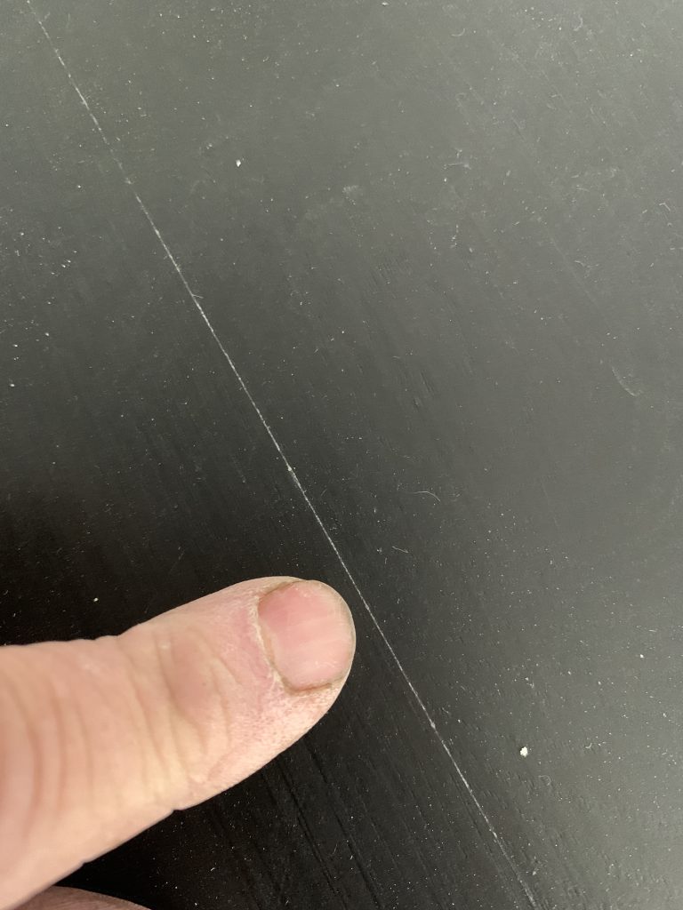 A picture of White Line Syndrome in a hardwood floor. 
